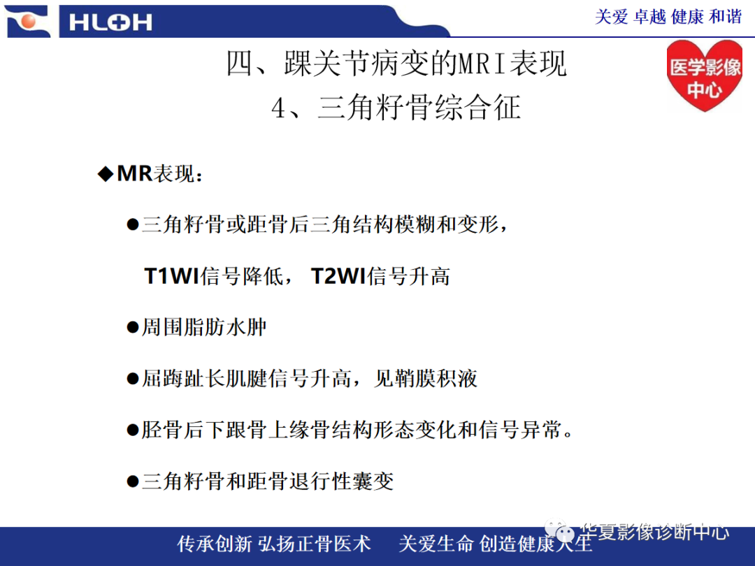 影像PPT - 【PPT】踝关节病变的MRI诊断-109