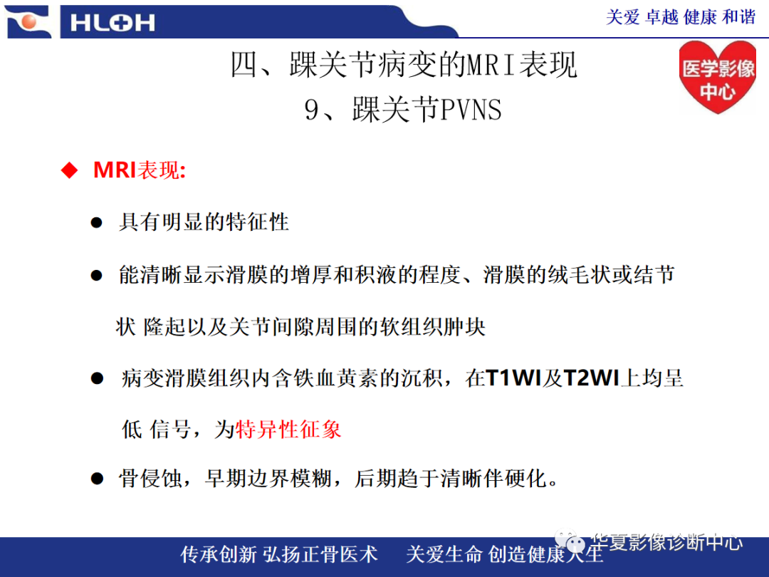 影像PPT - 【PPT】踝关节病变的MRI诊断-134