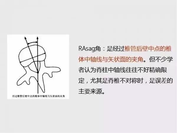 影像PPT - 【PPT】脊柱侧凸相关测量-25