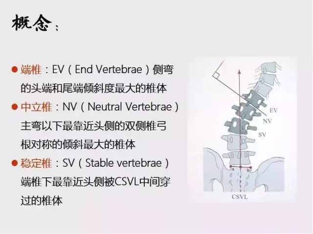 影像PPT - 【PPT】脊柱侧凸相关测量-2