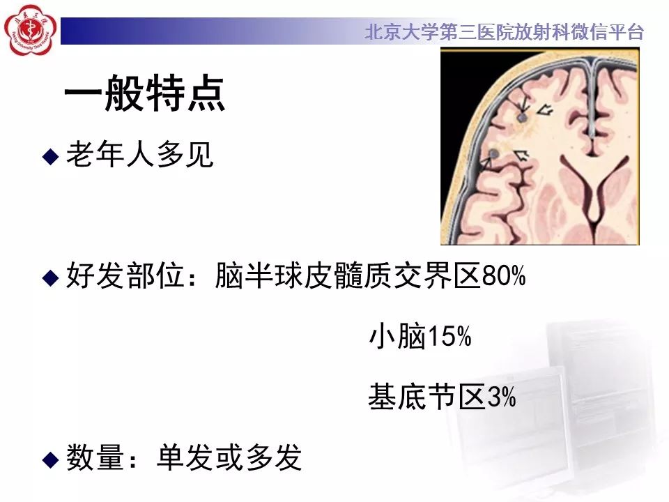 影像PPT - 【PPT】脑实质转移瘤-12