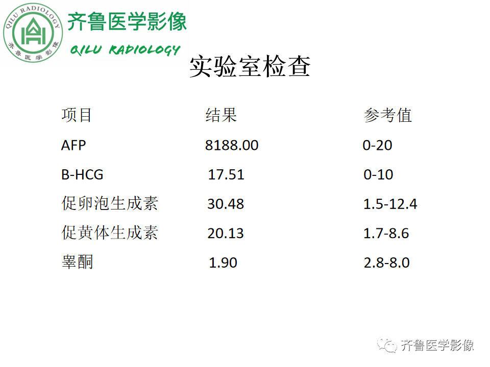 影像PPT - 【病例】腹膜后精原细胞瘤2例影像特征-3