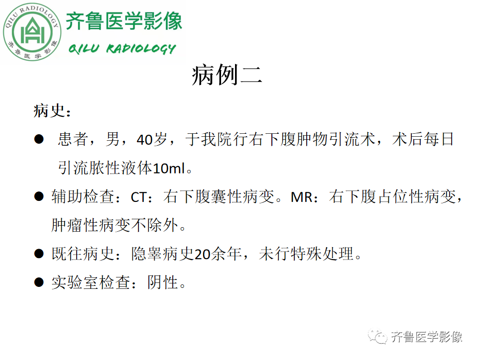 影像PPT - 【病例】腹膜后精原细胞瘤2例影像特征-7