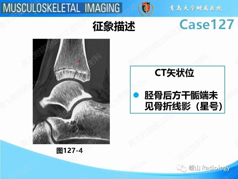 影像PPT - 【PPT】三平面骨折-23