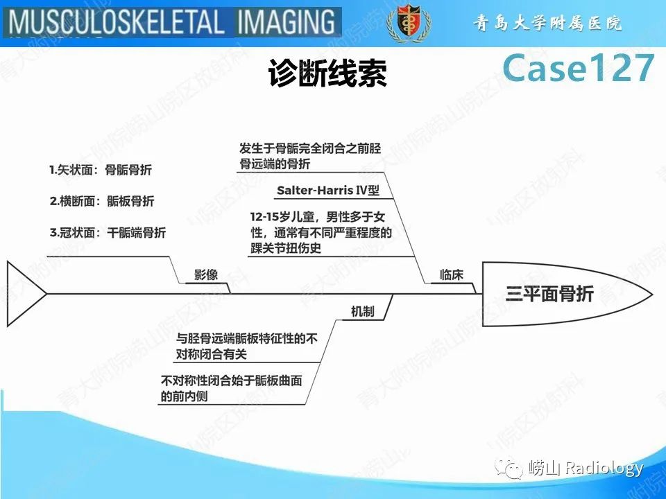 影像PPT - 【PPT】三平面骨折-24