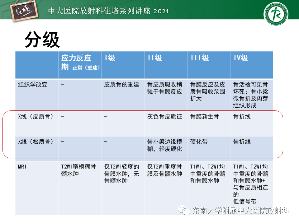 影像PPT - 【PPT】应力性骨折及与病理性骨折的鉴别诊断-11
