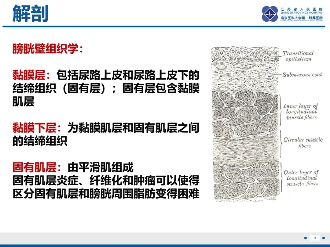 影像PPT - 【PPT】膀胱癌-15