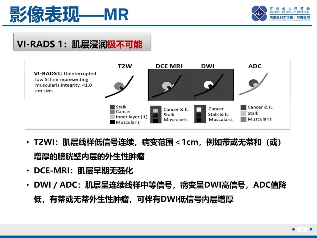 影像PPT - 【PPT】膀胱癌-33