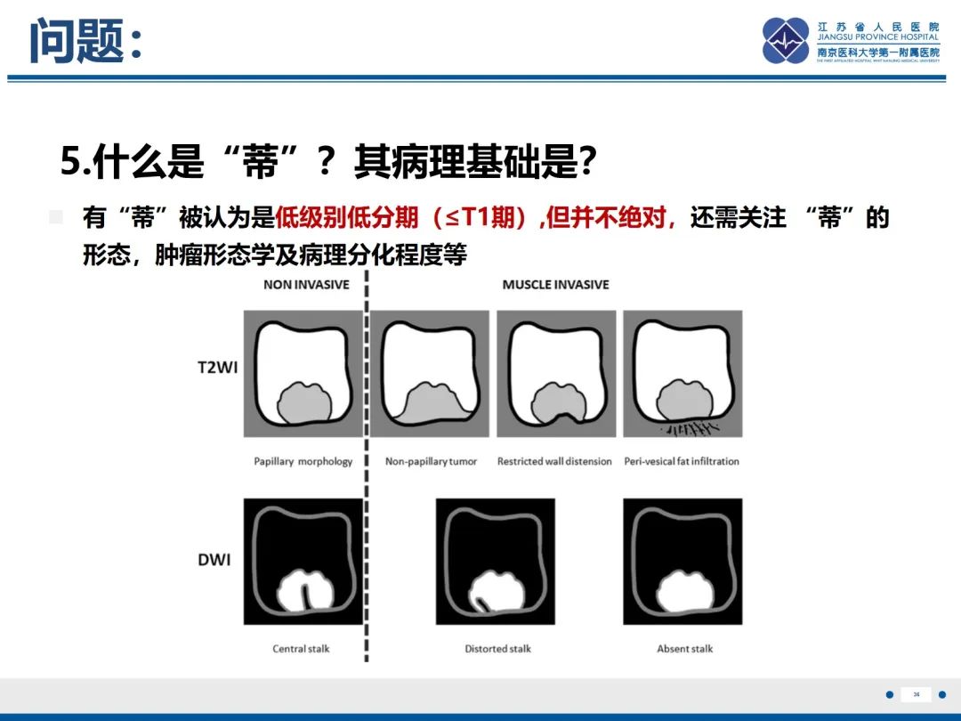 影像PPT - 【PPT】膀胱癌-37