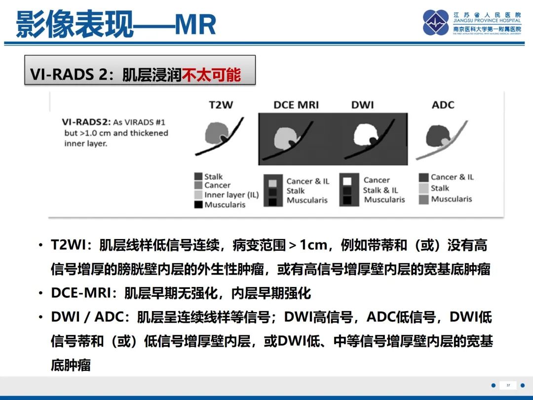 影像PPT - 【PPT】膀胱癌-38