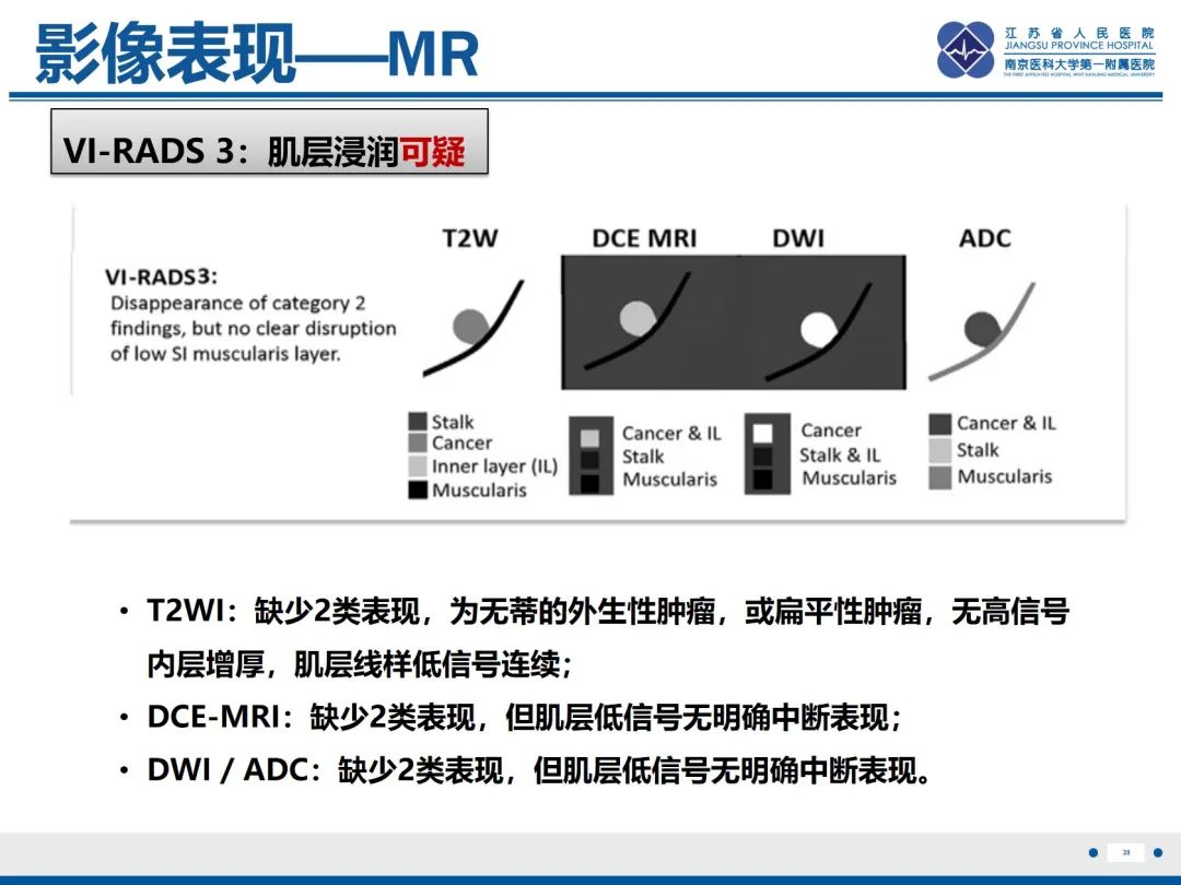 影像PPT - 【PPT】膀胱癌-40