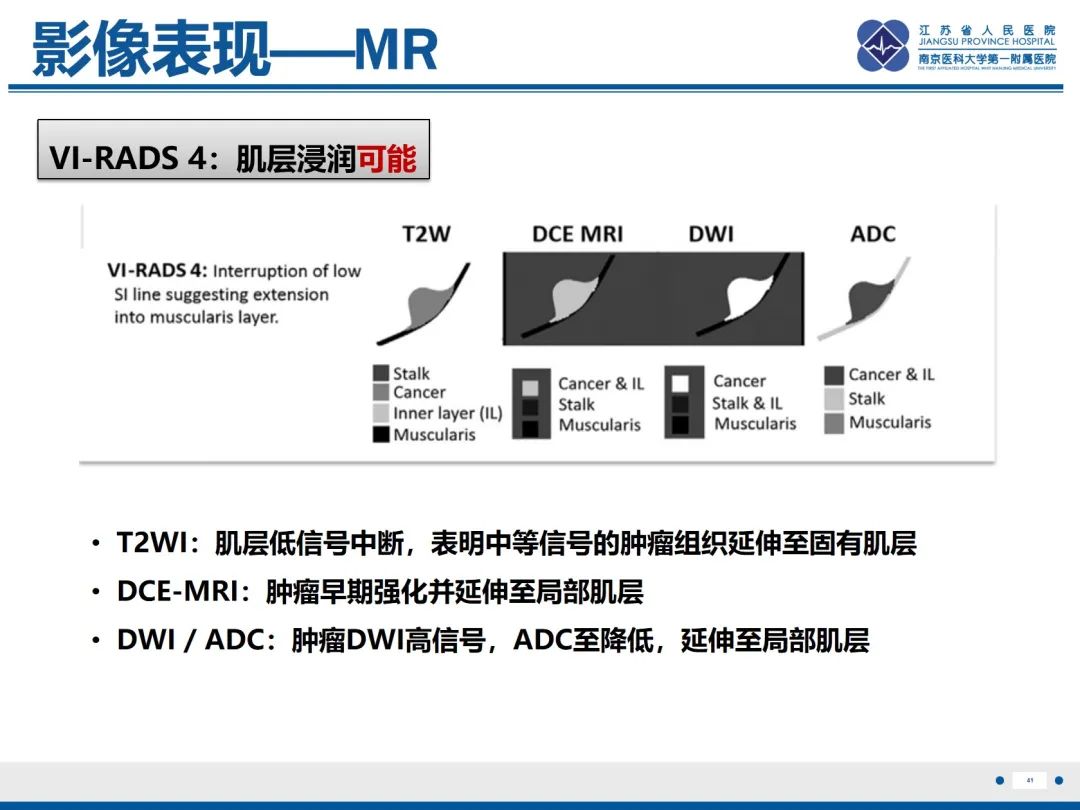 影像PPT - 【PPT】膀胱癌-42