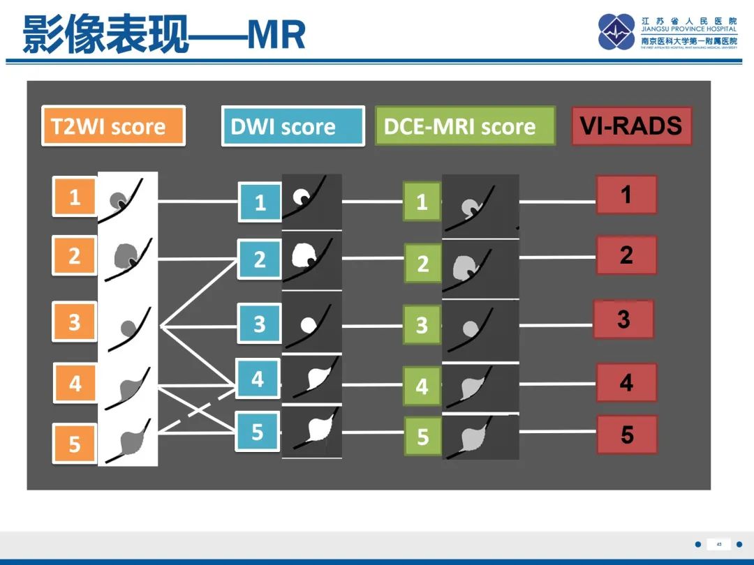 影像PPT - 【PPT】膀胱癌-46