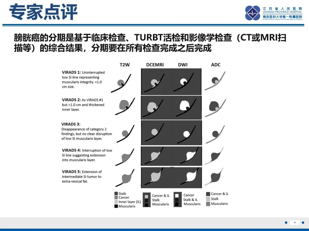 影像PPT - 【PPT】膀胱癌-57