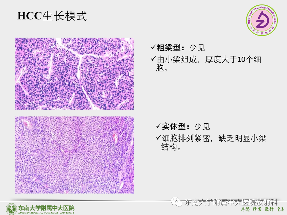 影像PPT - 【PPT】“理”“影”“外”合——肝细胞肝癌-8 影像PPT - 【PPT】“理”“影”“外”合——肝细胞肝癌-8
