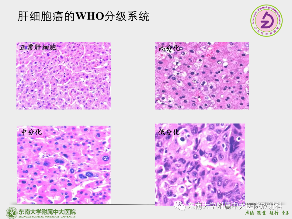影像PPT - 【PPT】“理”“影”“外”合——肝细胞肝癌-9 影像PPT - 【PPT】“理”“影”“外”合——肝细胞肝癌-9