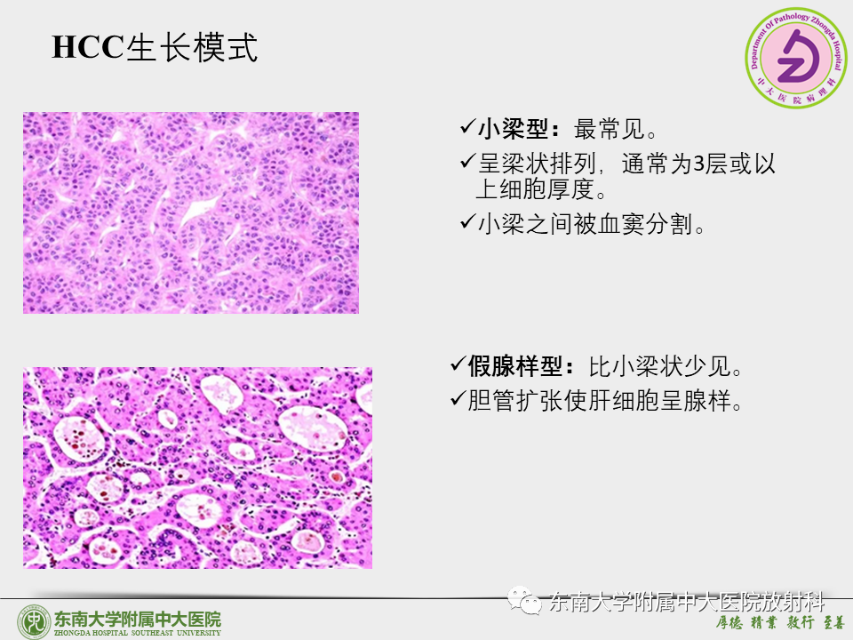 影像PPT - 【PPT】“理”“影”“外”合——肝细胞肝癌-7 影像PPT - 【PPT】“理”“影”“外”合——肝细胞肝癌-7