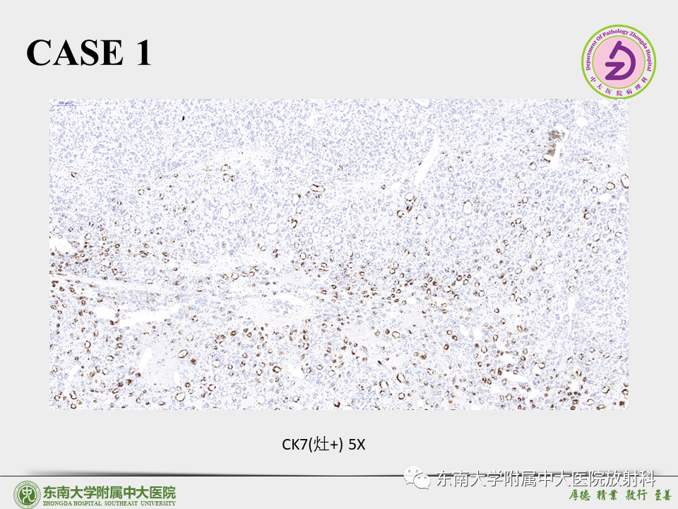 影像PPT - 【PPT】“理”“影”“外”合——肝细胞肝癌-15 影像PPT - 【PPT】“理”“影”“外”合——肝细胞肝癌-15