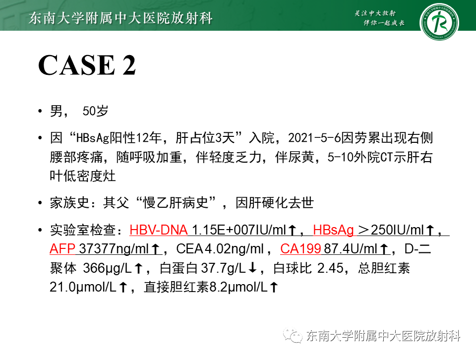 影像PPT - 【PPT】“理”“影”“外”合——肝细胞肝癌-20 影像PPT - 【PPT】“理”“影”“外”合——肝细胞肝癌-20