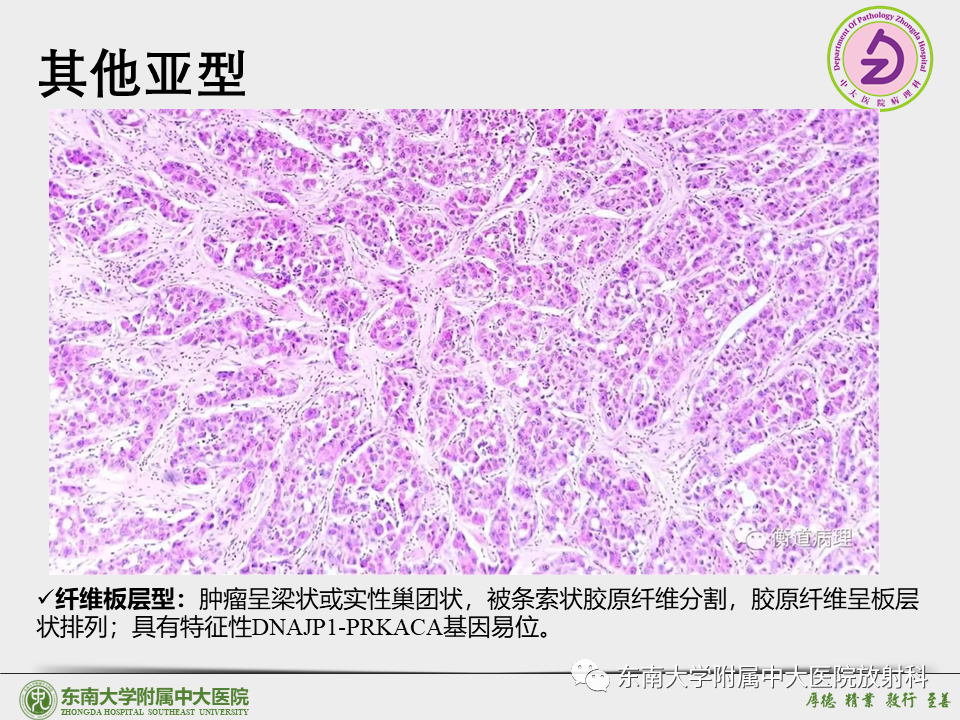 影像PPT - 【PPT】“理”“影”“外”合——肝细胞肝癌-17 影像PPT - 【PPT】“理”“影”“外”合——肝细胞肝癌-17