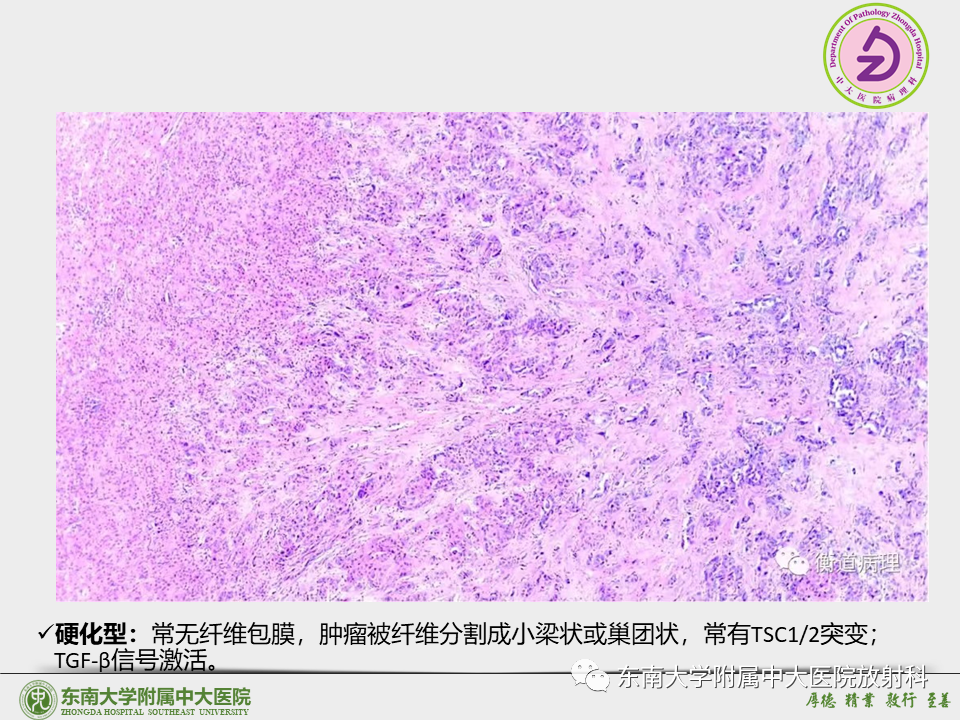 影像PPT - 【PPT】“理”“影”“外”合——肝细胞肝癌-18 影像PPT - 【PPT】“理”“影”“外”合——肝细胞肝癌-18