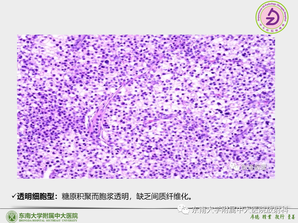 影像PPT - 【PPT】“理”“影”“外”合——肝细胞肝癌-19 影像PPT - 【PPT】“理”“影”“外”合——肝细胞肝癌-19