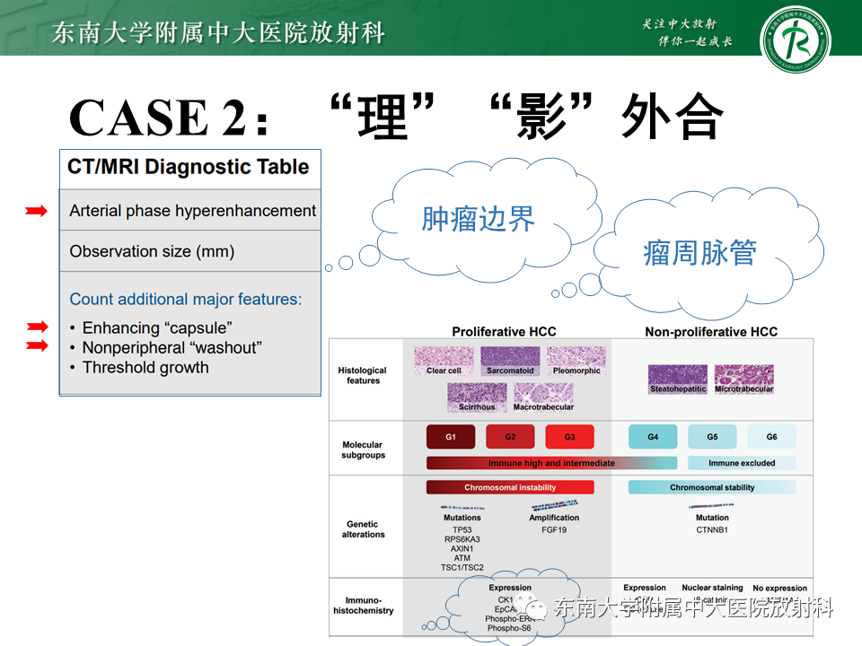 影像PPT - 【PPT】“理”“影”“外”合——肝细胞肝癌-23 影像PPT - 【PPT】“理”“影”“外”合——肝细胞肝癌-23