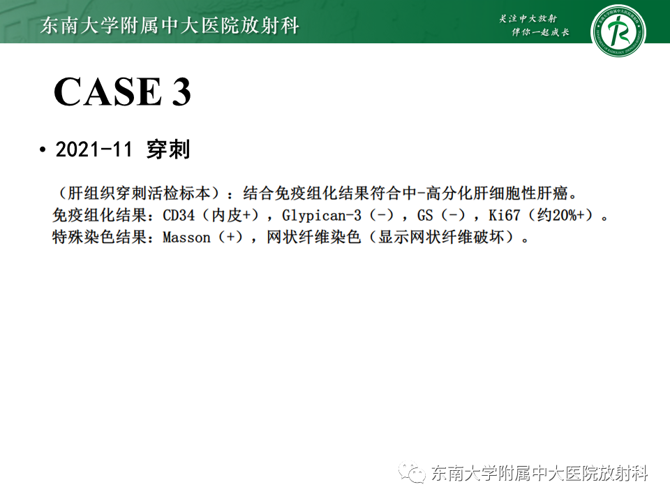 影像PPT - 【PPT】“理”“影”“外”合——肝细胞肝癌-28 影像PPT - 【PPT】“理”“影”“外”合——肝细胞肝癌-28