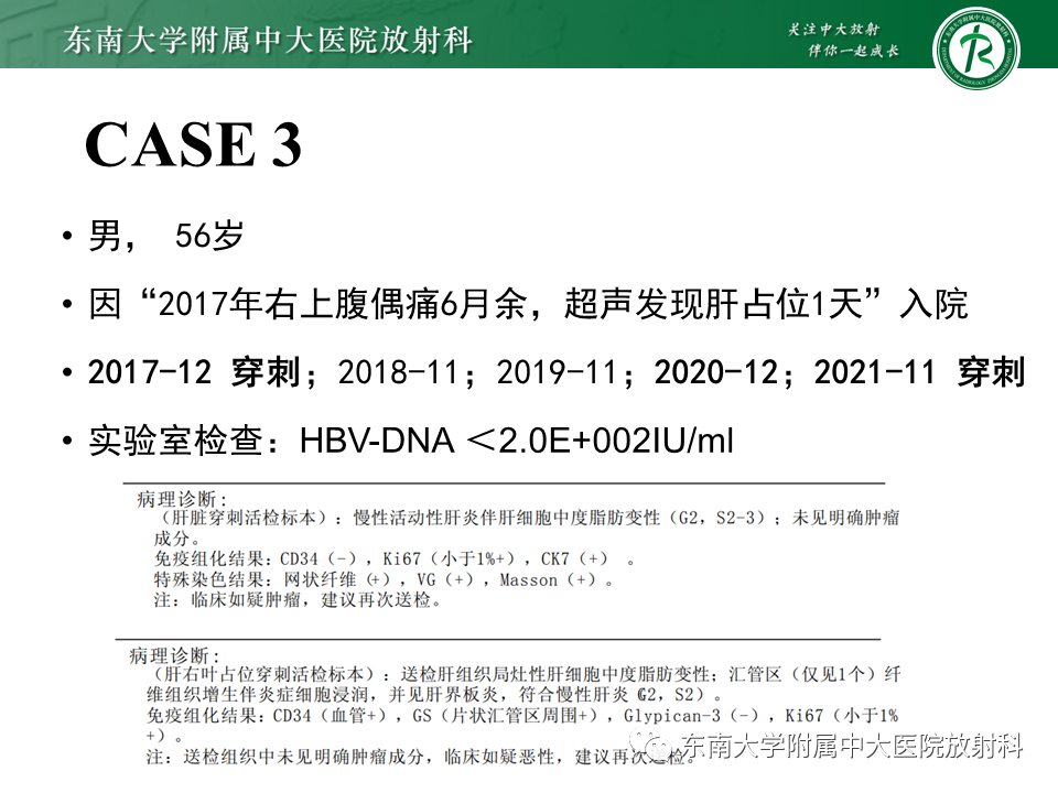 影像PPT - 【PPT】“理”“影”“外”合——肝细胞肝癌-27 影像PPT - 【PPT】“理”“影”“外”合——肝细胞肝癌-27