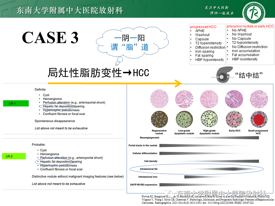 影像PPT - 【PPT】“理”“影”“外”合——肝细胞肝癌-30 影像PPT - 【PPT】“理”“影”“外”合——肝细胞肝癌-30