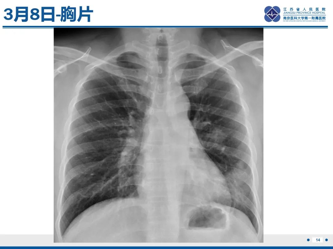 影像PPT - 【PPT】肺隐球菌病-15