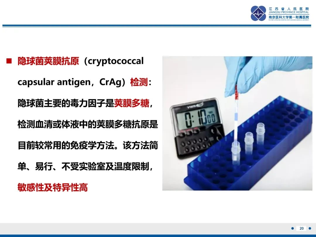 影像PPT - 【PPT】肺隐球菌病-21
