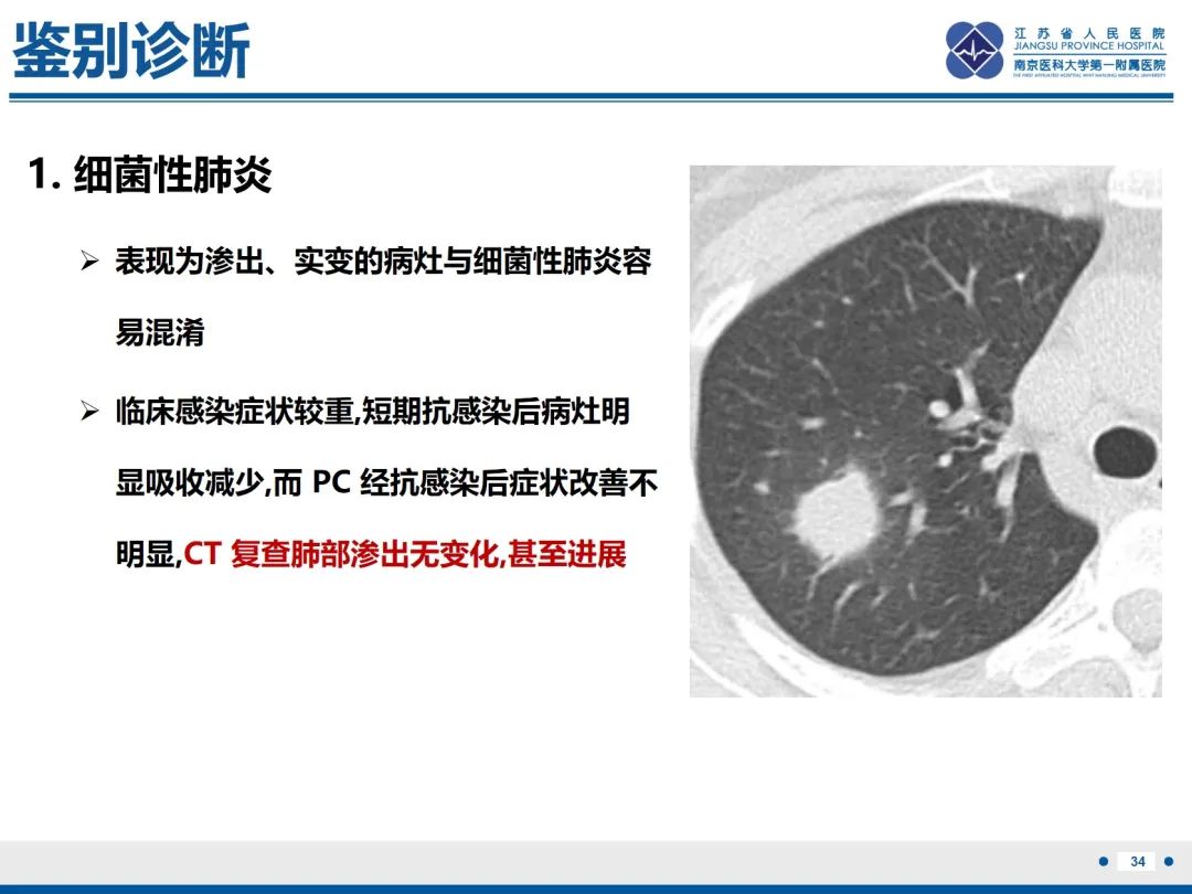 影像PPT - 【PPT】肺隐球菌病-35