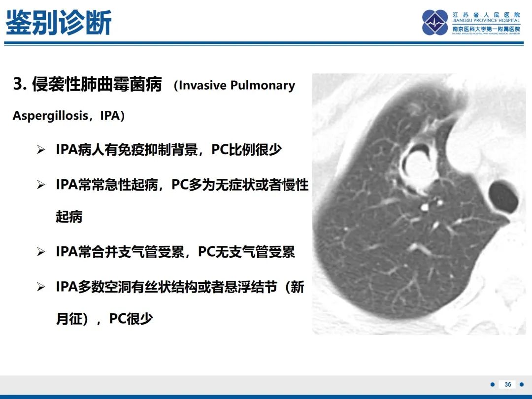 影像PPT - 【PPT】肺隐球菌病-37