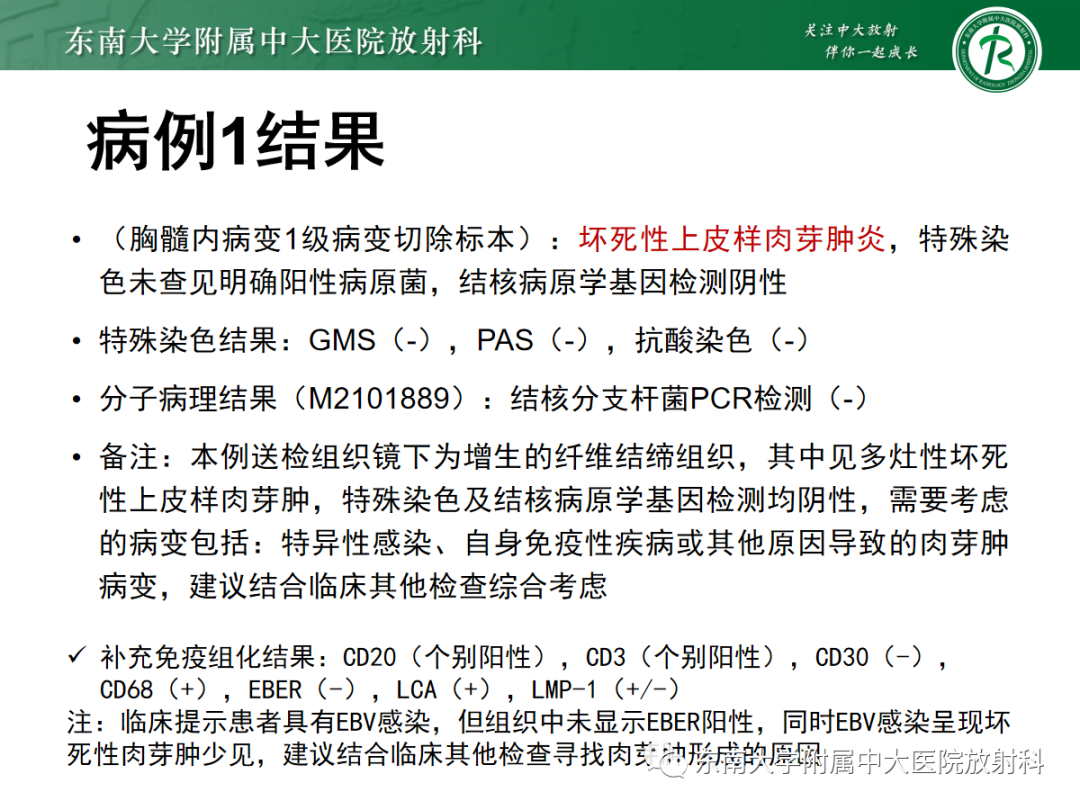 影像PPT - 【PPT】脊髓病例随访—坏死性上皮样肉芽肿炎 VS 血管母细胞瘤 VS 视神经脊髓炎谱系疾病-5 影像PPT - 【PPT】脊髓病例随访—坏死性上皮样肉芽肿炎 VS 血管母细胞瘤 VS 视神经脊髓炎谱系疾病-5