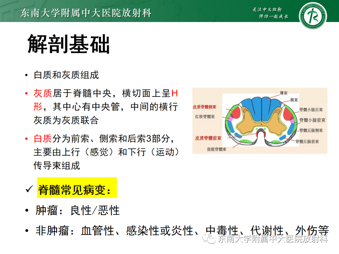 影像PPT - 【PPT】脊髓病例随访—坏死性上皮样肉芽肿炎 VS 血管母细胞瘤 VS 视神经脊髓炎谱系疾病-12 影像PPT - 【PPT】脊髓病例随访—坏死性上皮样肉芽肿炎 VS 血管母细胞瘤 VS 视神经脊髓炎谱系疾病-12