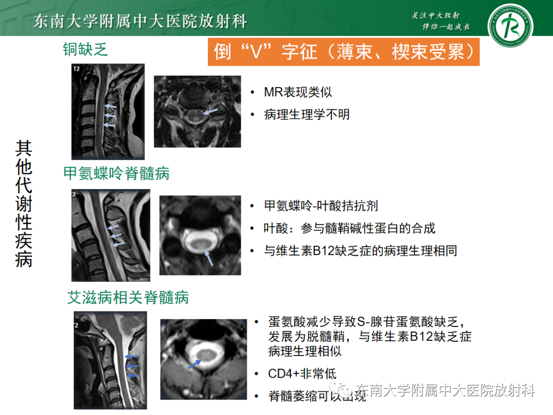 影像PPT - 【PPT】脊髓病例随访—坏死性上皮样肉芽肿炎 VS 血管母细胞瘤 VS 视神经脊髓炎谱系疾病-27 影像PPT - 【PPT】脊髓病例随访—坏死性上皮样肉芽肿炎 VS 血管母细胞瘤 VS 视神经脊髓炎谱系疾病-27