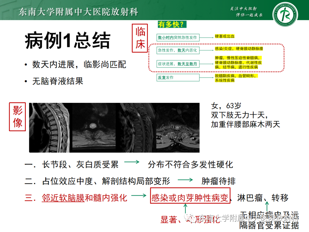 影像PPT - 【PPT】脊髓病例随访—坏死性上皮样肉芽肿炎 VS 血管母细胞瘤 VS 视神经脊髓炎谱系疾病-38 影像PPT - 【PPT】脊髓病例随访—坏死性上皮样肉芽肿炎 VS 血管母细胞瘤 VS 视神经脊髓炎谱系疾病-38