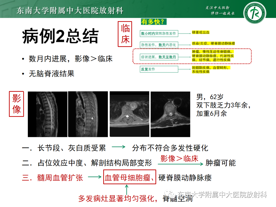 影像PPT - 【PPT】脊髓病例随访—坏死性上皮样肉芽肿炎 VS 血管母细胞瘤 VS 视神经脊髓炎谱系疾病-40 影像PPT - 【PPT】脊髓病例随访—坏死性上皮样肉芽肿炎 VS 血管母细胞瘤 VS 视神经脊髓炎谱系疾病-40