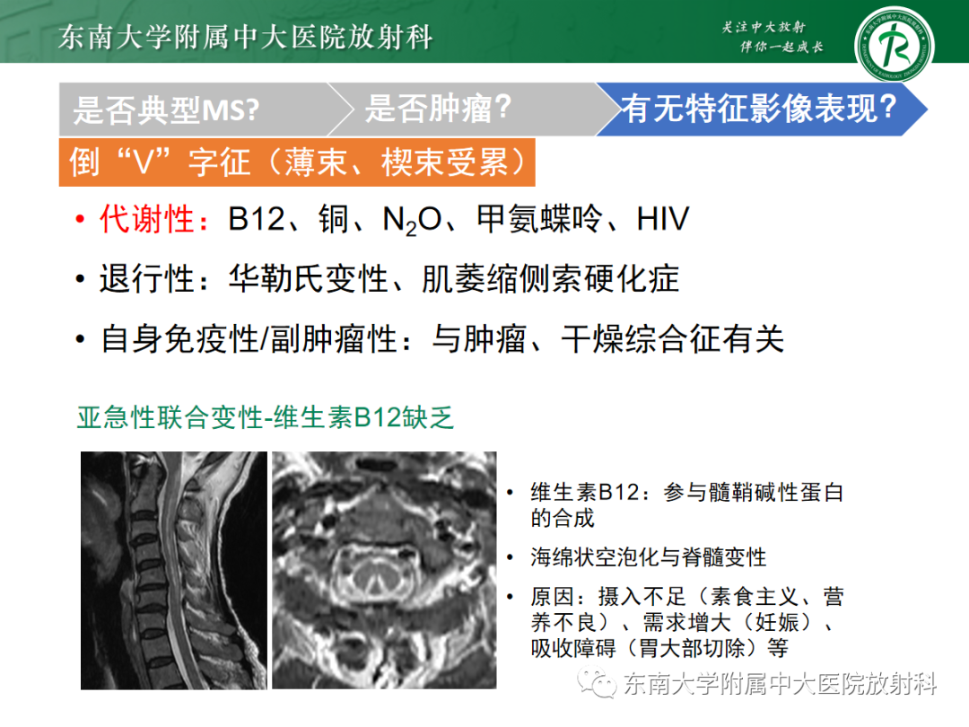 影像PPT - 【PPT】脊髓病例随访—坏死性上皮样肉芽肿炎 VS 血管母细胞瘤 VS 视神经脊髓炎谱系疾病-26 影像PPT - 【PPT】脊髓病例随访—坏死性上皮样肉芽肿炎 VS 血管母细胞瘤 VS 视神经脊髓炎谱系疾病-26