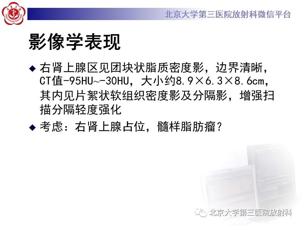 影像PPT - 【PPT】肾上腺髓样脂肪瘤-6
