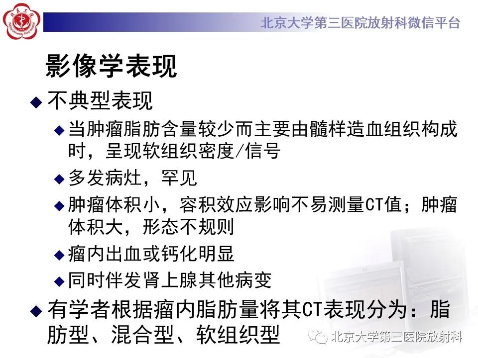 影像PPT - 【PPT】肾上腺髓样脂肪瘤-15