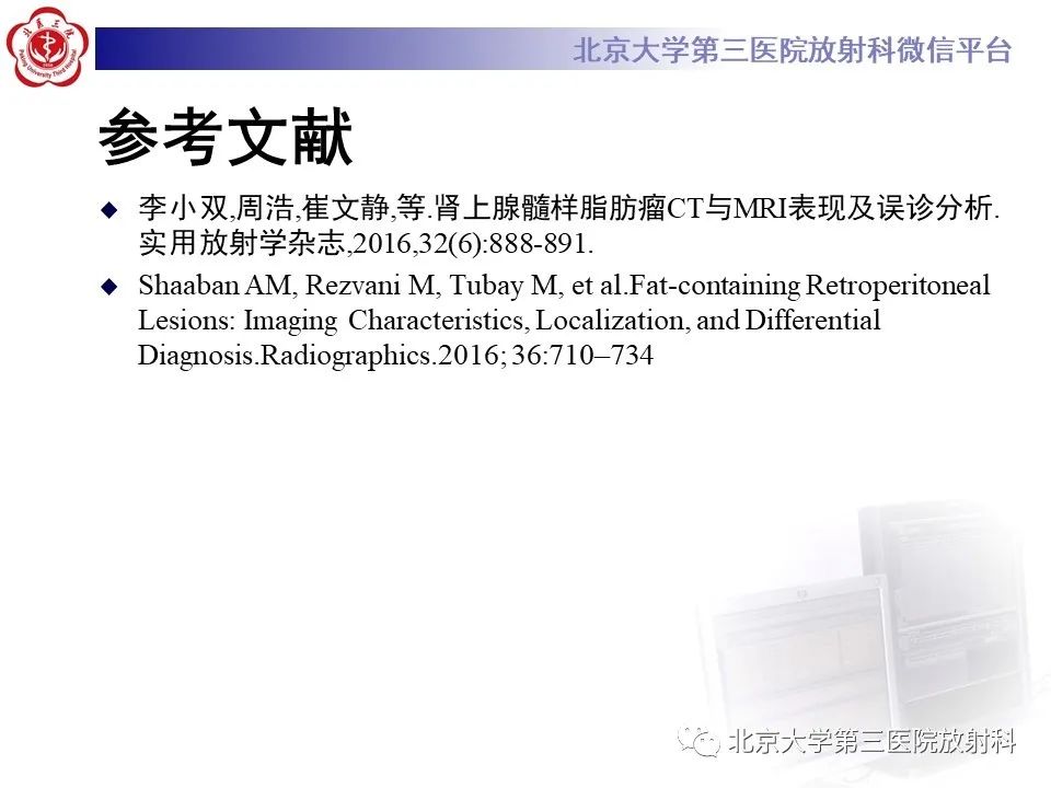 影像PPT - 【PPT】肾上腺髓样脂肪瘤-29