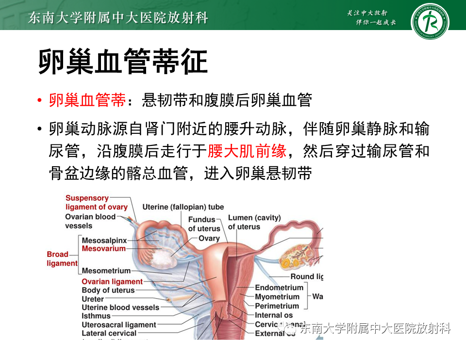 影像PPT - 【PPT】卵巢纤维卵泡膜细胞瘤-12