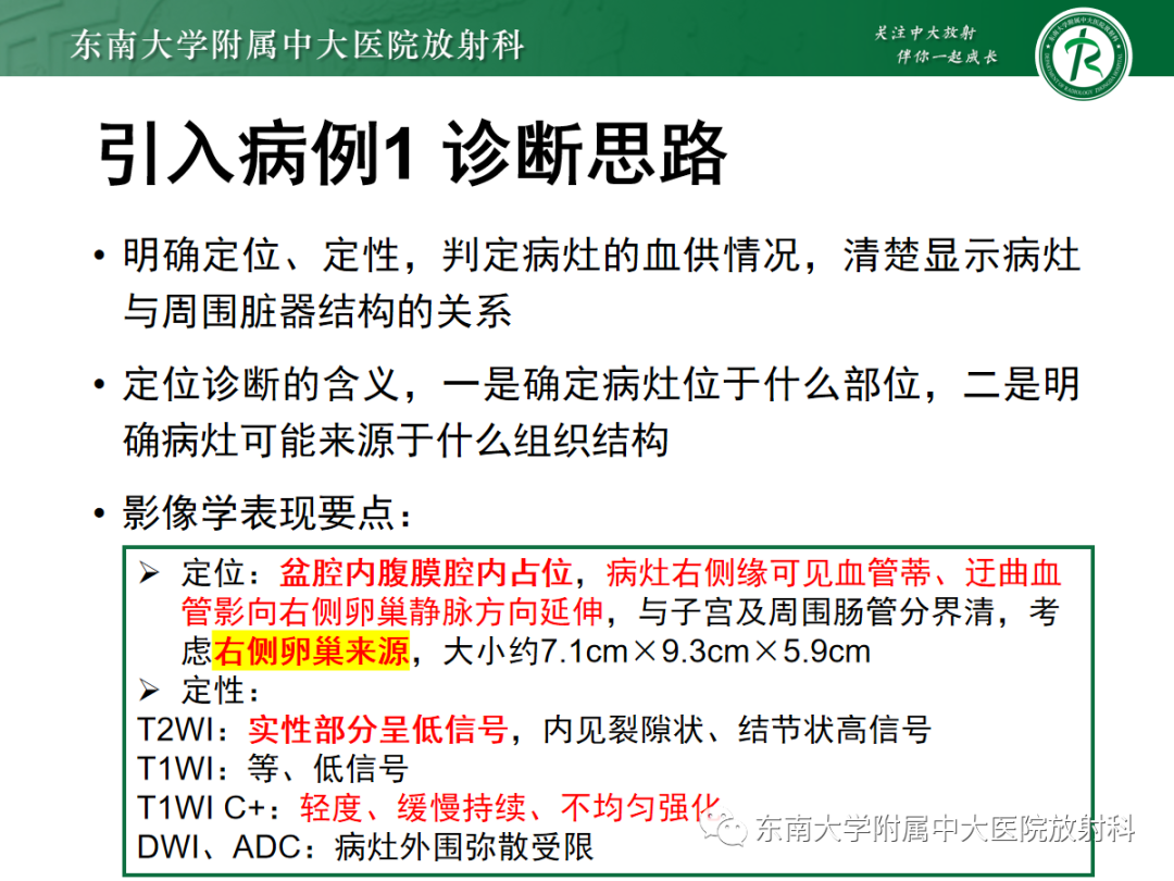 影像PPT - 【PPT】卵巢纤维卵泡膜细胞瘤-1