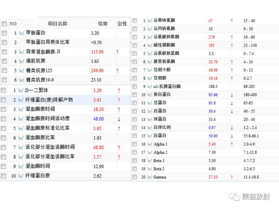 影像PPT - 【病例】布加综合征（肝静脉下腔静脉阻塞综合征）2例CT影像-3