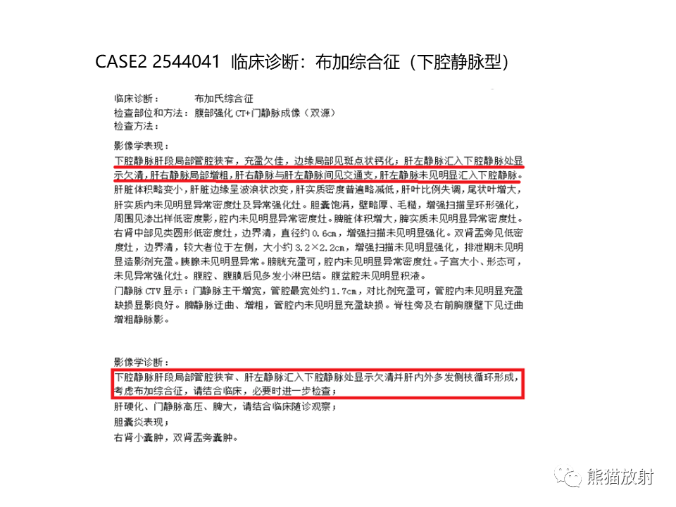 影像PPT - 【病例】布加综合征（肝静脉下腔静脉阻塞综合征）2例CT影像-19