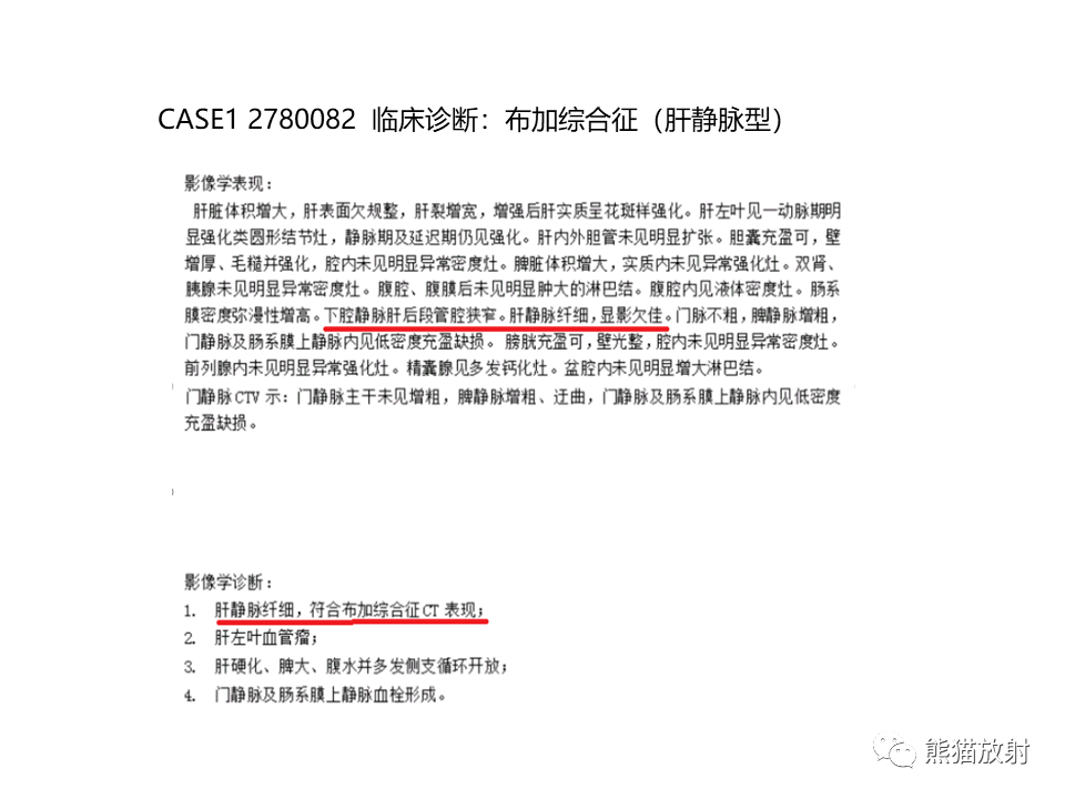 影像PPT - 【病例】布加综合征（肝静脉下腔静脉阻塞综合征）2例CT影像-18