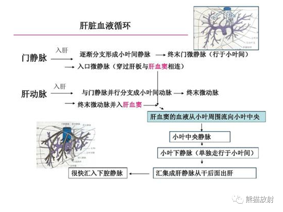 影像PPT - 【病例】布加综合征（肝静脉下腔静脉阻塞综合征）2例CT影像-20