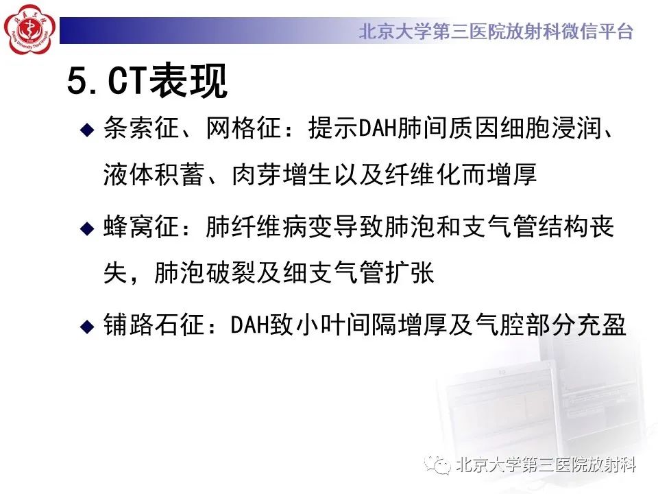 影像PPT - 【PPT】弥漫性肺泡出血-15